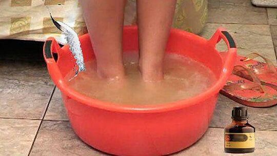 Bathing in hot water with iodine is one of the stages of treating toenail fungus