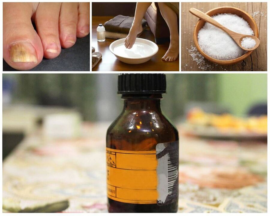 bath against nail fungus