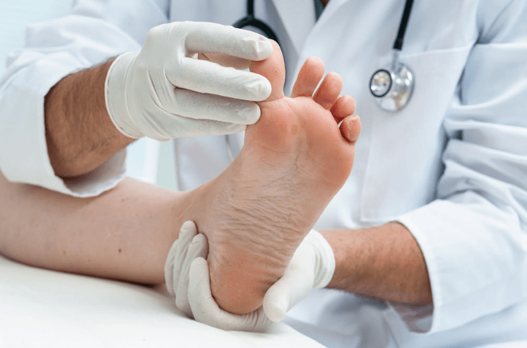 Nail fungal treatment