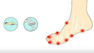 The cause of the fungus on the toes