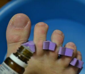 Prepare to treat nails with anti-fungal drops